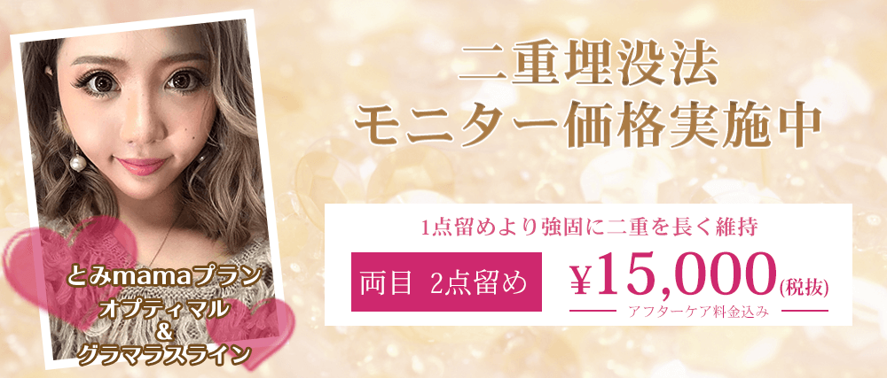 二重術埋没法を両目2点留め15,000円(税抜)